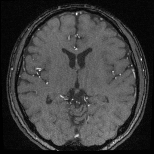 Click on the Serie image to view the images of VILLANUEVA, WILLIAM A.